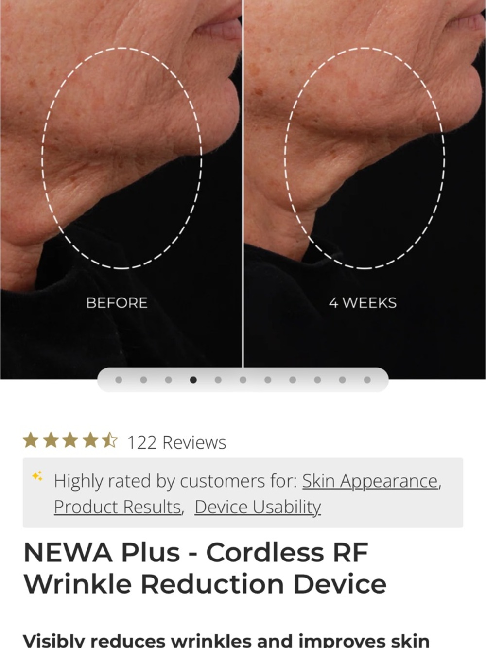 NEWA Plus - Cordless RF
Wrinkle Reduction Device - Picture 6 of 6
